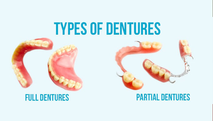 full and partial dentures at goklani's cosmetic and dental clinic aurangabad